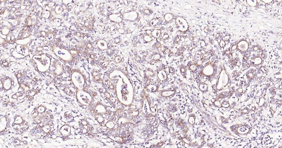 Anti-Thrombin Receptor Polyclonal Antibody