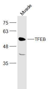 Anti-TFEB Polyclonal Antibody