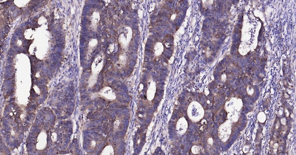 Anti-Thrombin Receptor Polyclonal Antibody