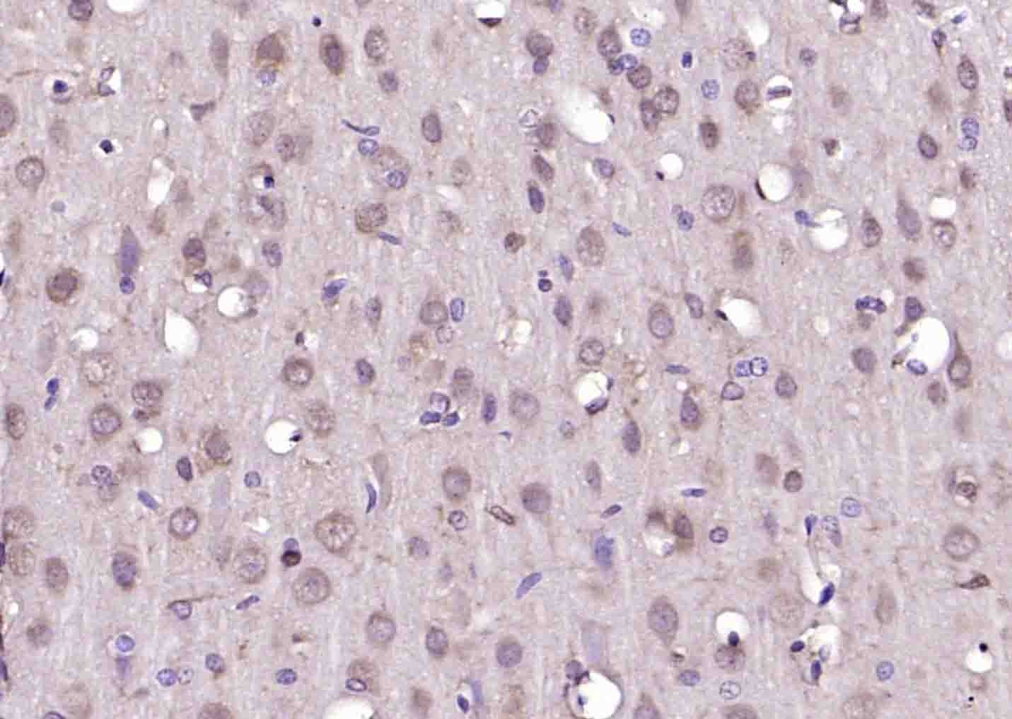 Anti-STK11 Polyclonal Antibody
