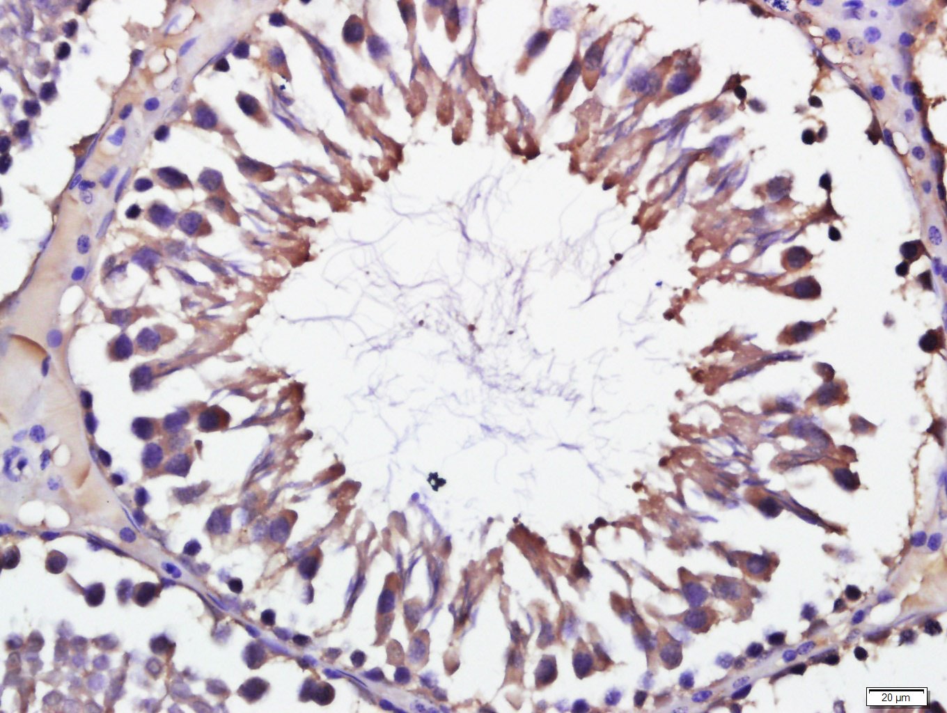 Anti-STK11 Polyclonal Antibody
