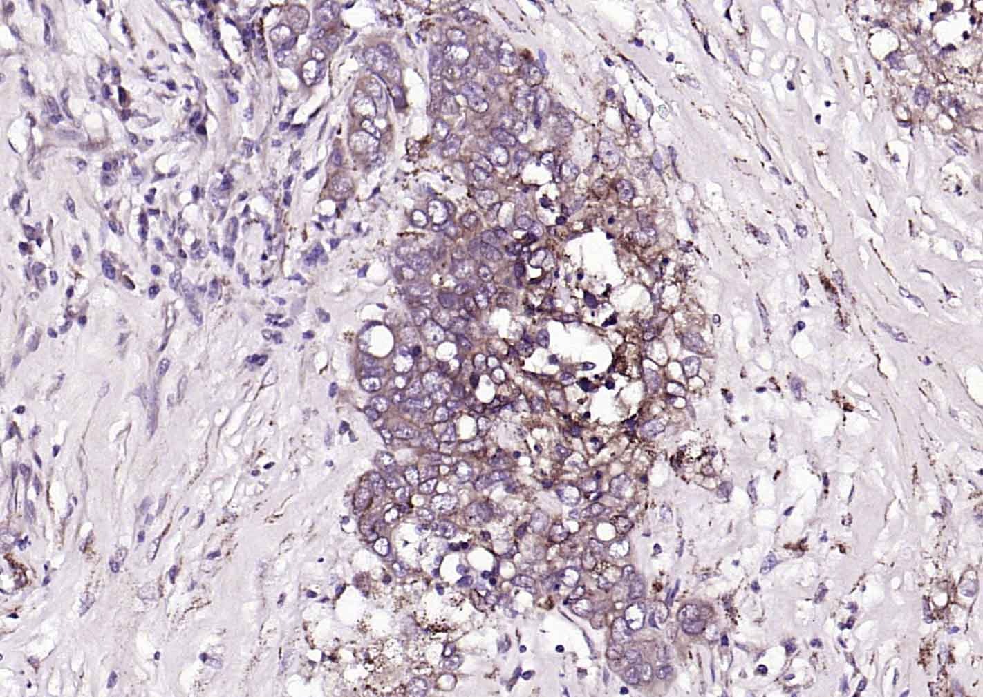 Anti-TGFBR2 Polyclonal Antibody