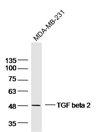 Anti-TGF beta 2 Polyclonal Antibody