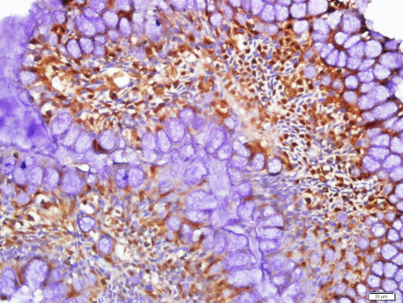 Anti-STK11 Polyclonal Antibody