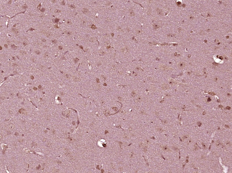 Anti-TFEB Polyclonal Antibody