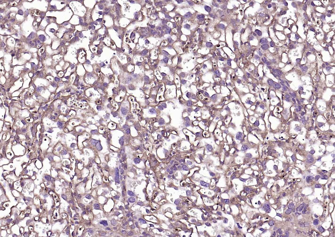 Anti-TGFBR2 Polyclonal Antibody