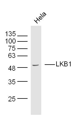 Anti-STK11 Polyclonal Antibody