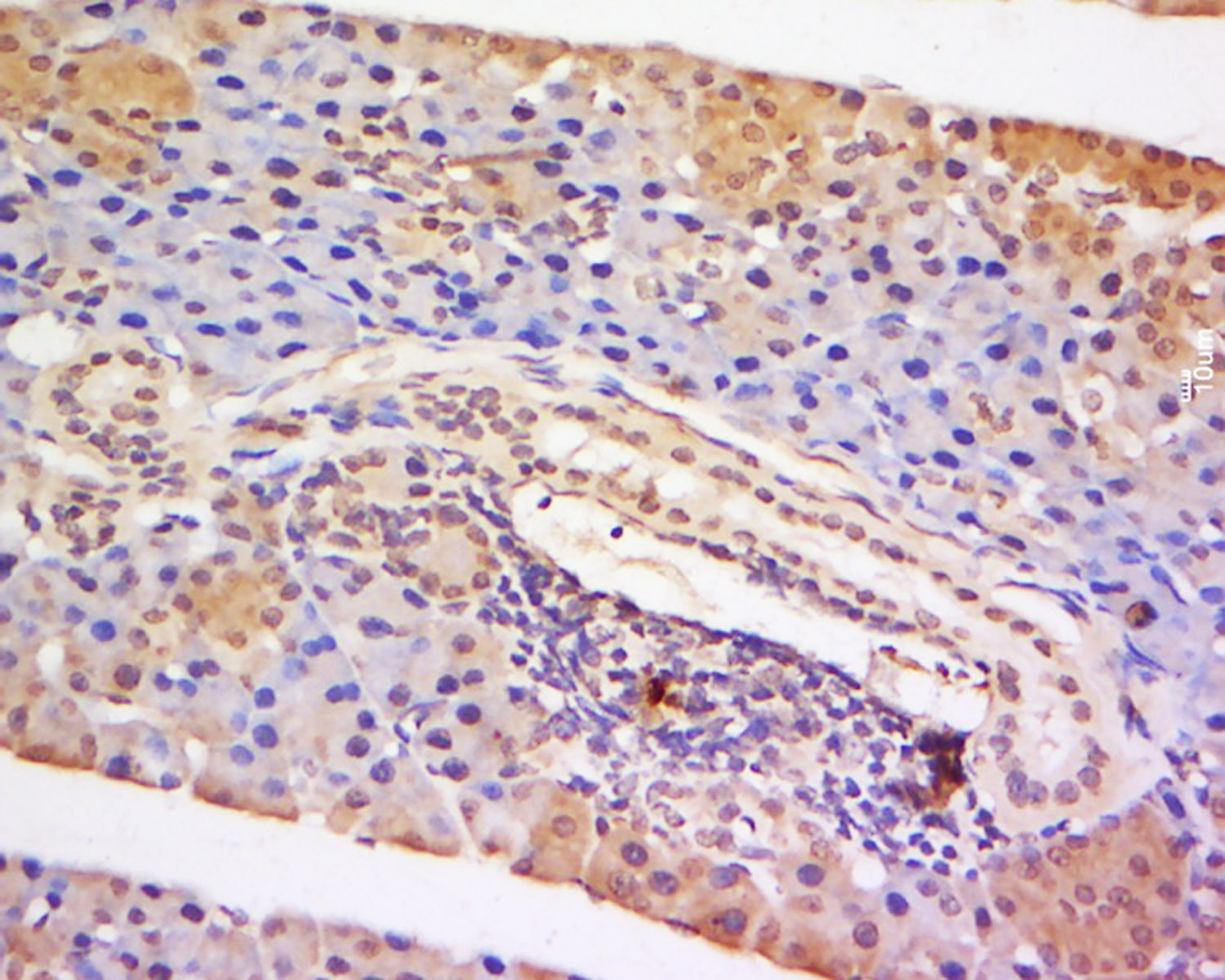 Anti-STAT5 Polyclonal Antibody