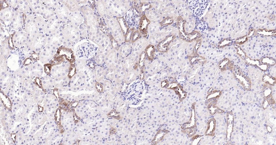 Anti-Thrombin Receptor Polyclonal Antibody