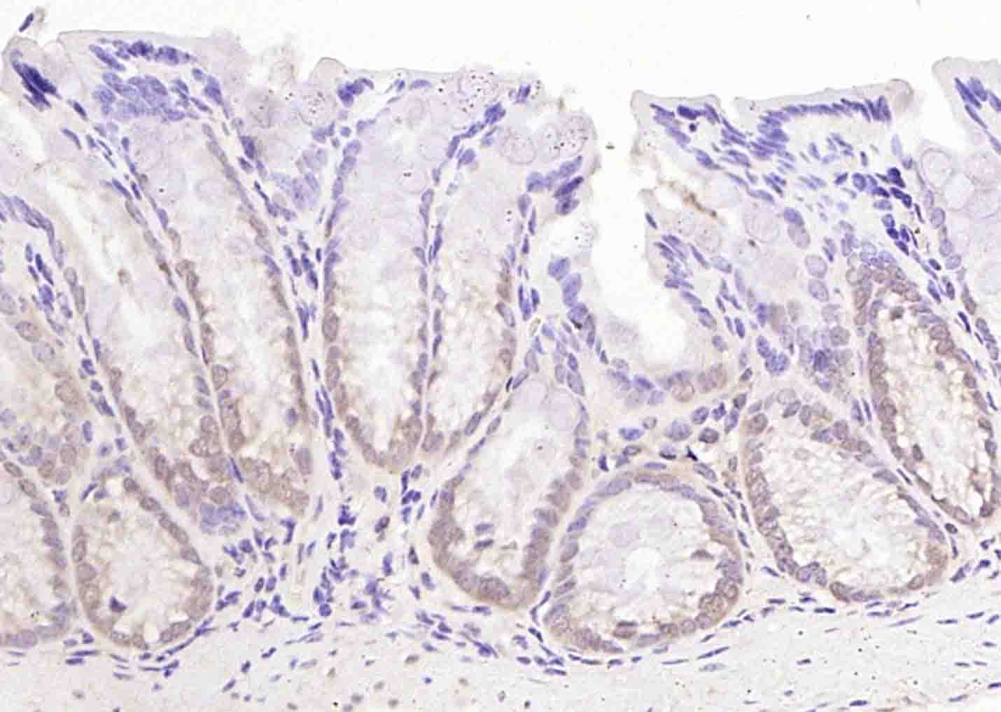 Anti-STK11 Polyclonal Antibody