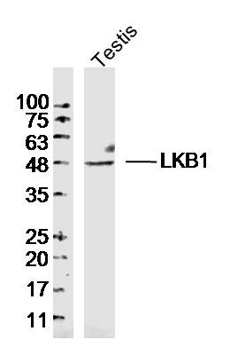 Anti-STK11 Polyclonal Antibody