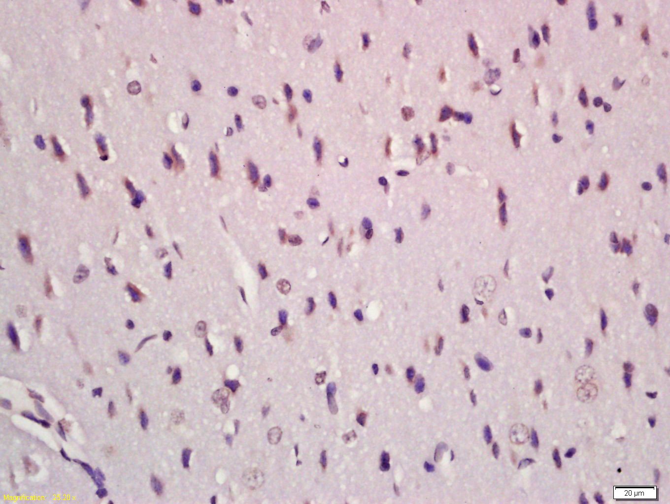 Anti-TGF beta 1/2/3 Polyclonal Antibody