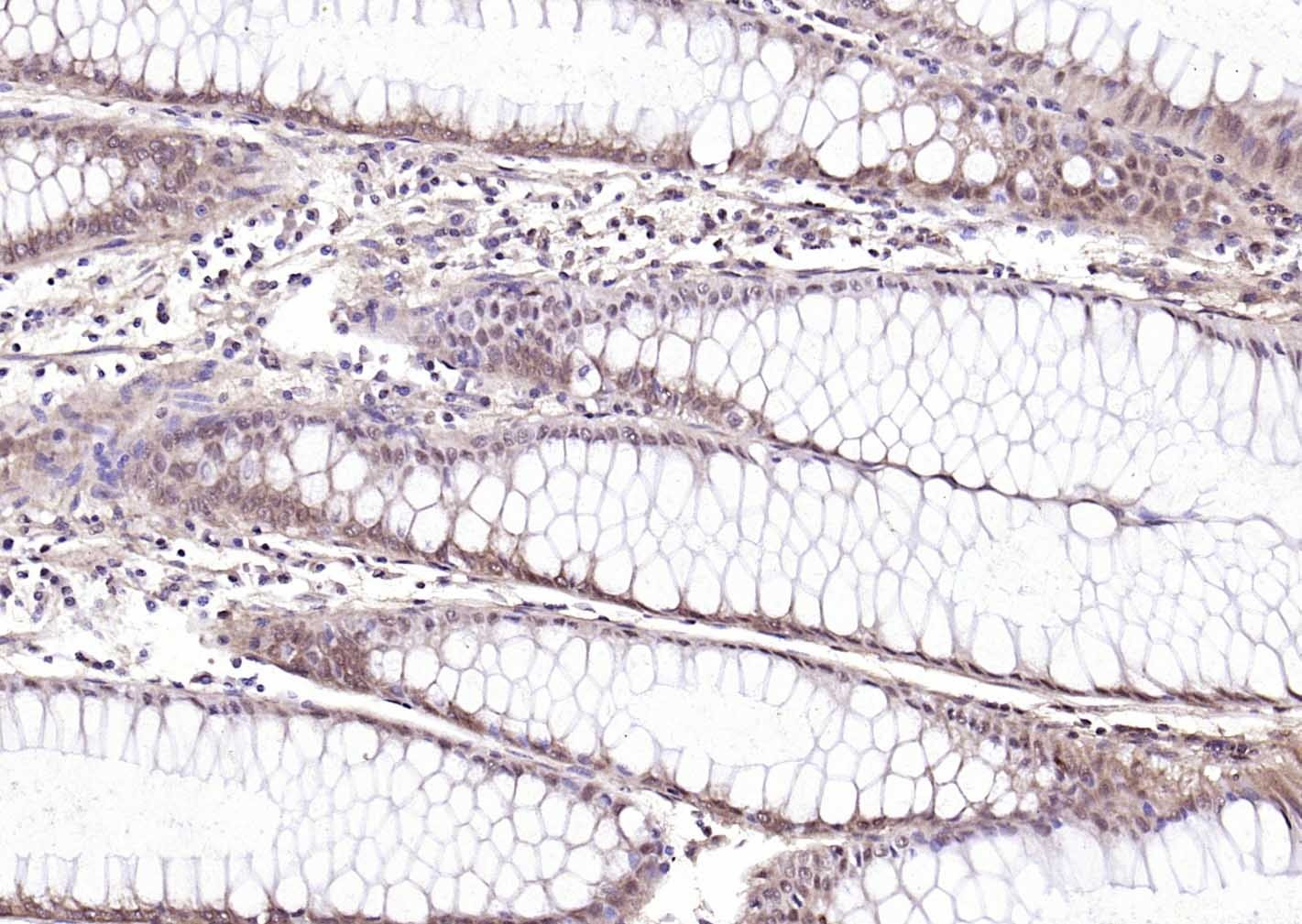 Anti-STK11 Polyclonal Antibody