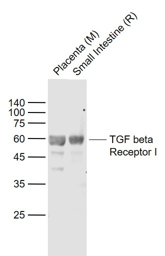 Anti-TGFBR1 Polyclonal Antibody