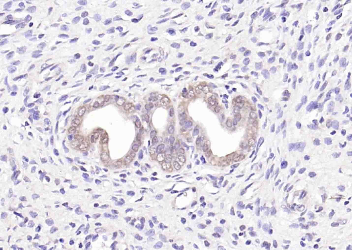 Anti-STK11 Polyclonal Antibody