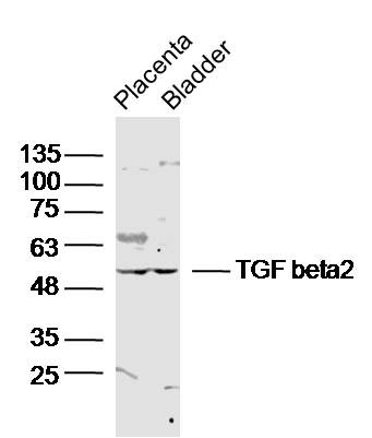 Anti-TGF beta 2 Polyclonal Antibody