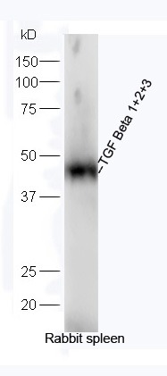 Anti-TGF beta 1/2/3 Polyclonal Antibody