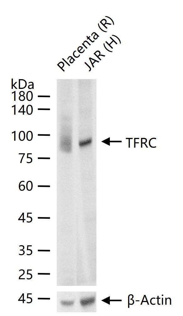 Anti-Transferrin Receptor/TFRC Antibody (4F227)