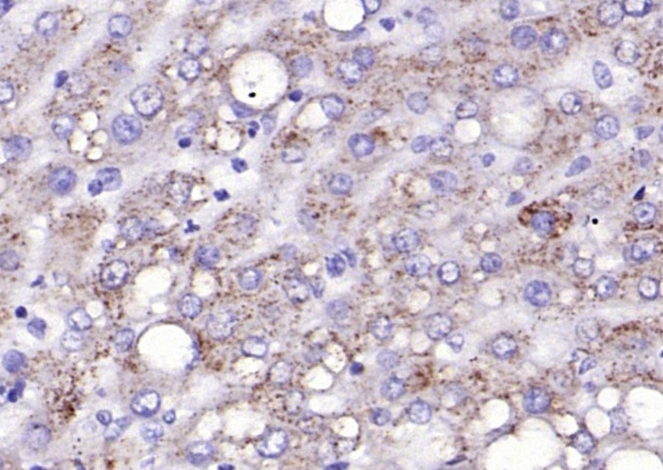 Anti-Transferrin Receptor/TFRC Polyclonal Antibody