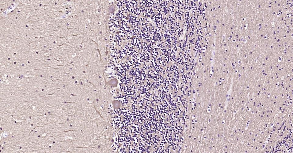 Anti-TUBB3 Antibody (3P633)