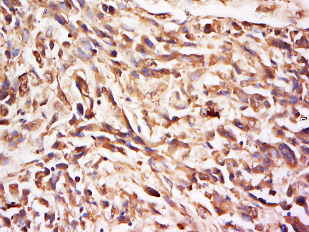 Anti-SYK Polyclonal Antibody