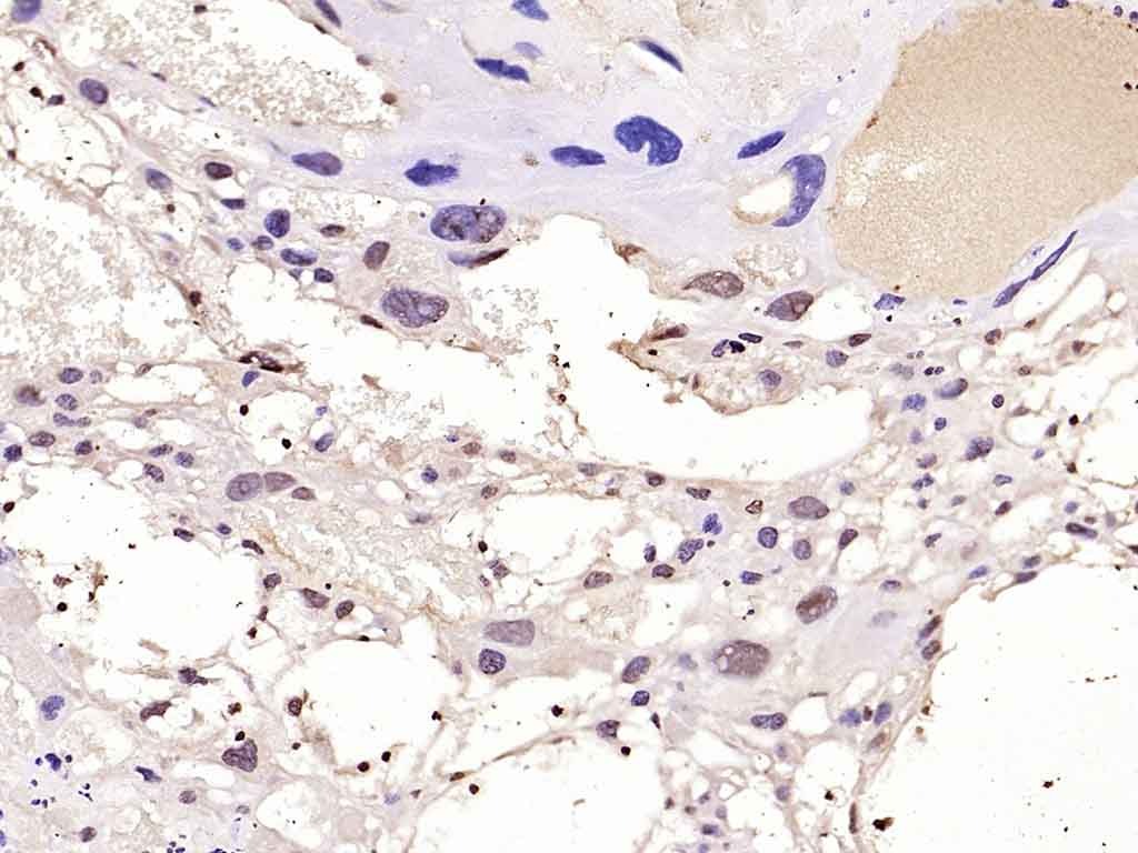 Anti-TWIST Polyclonal Antibody