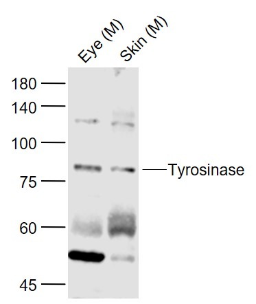 Anti-Tyrosinase/TYR Polyclonal Antibody