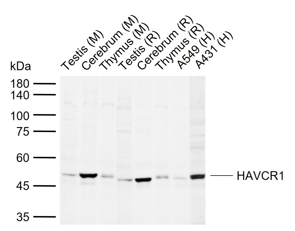 Anti-TIM-1/KIM-1/HAVCR1 Polyclonal Antibody 2