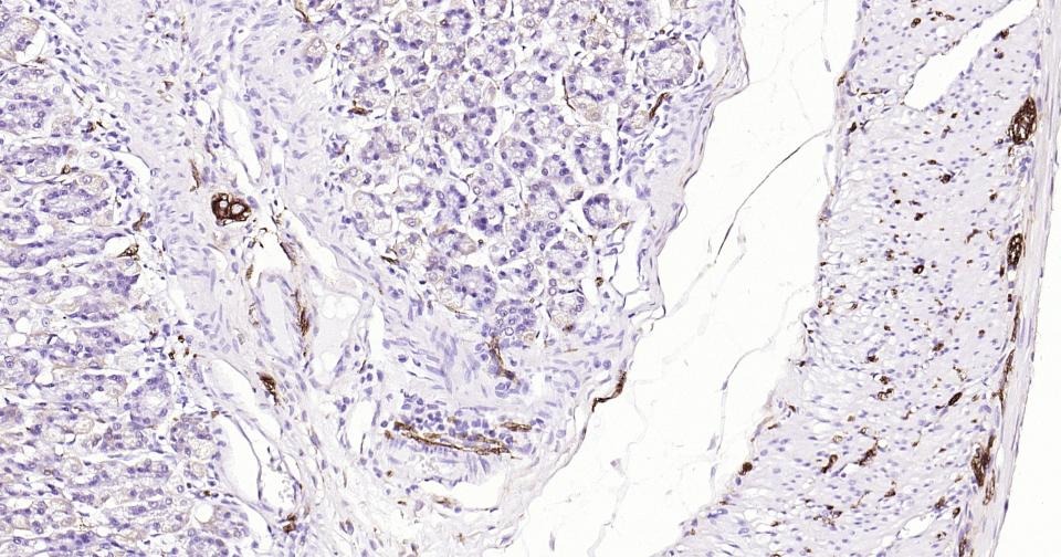 Anti-TUBB3 Antibody (3P633)