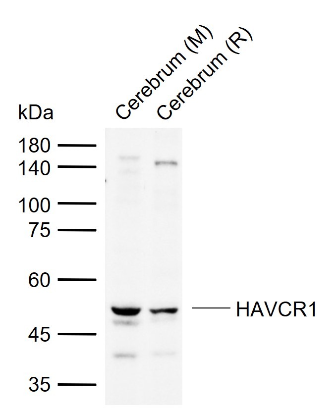 Anti-TIM-1/KIM-1/HAVCR1 Polyclonal Antibody