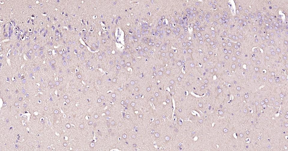 Anti-TUBB3 Antibody (3P633)