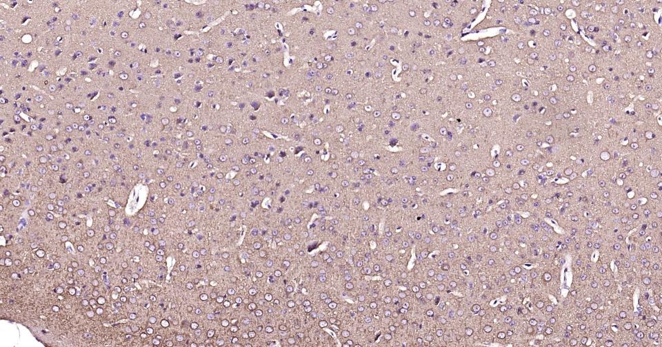 Anti-TUBB3 Antibody (3P633)