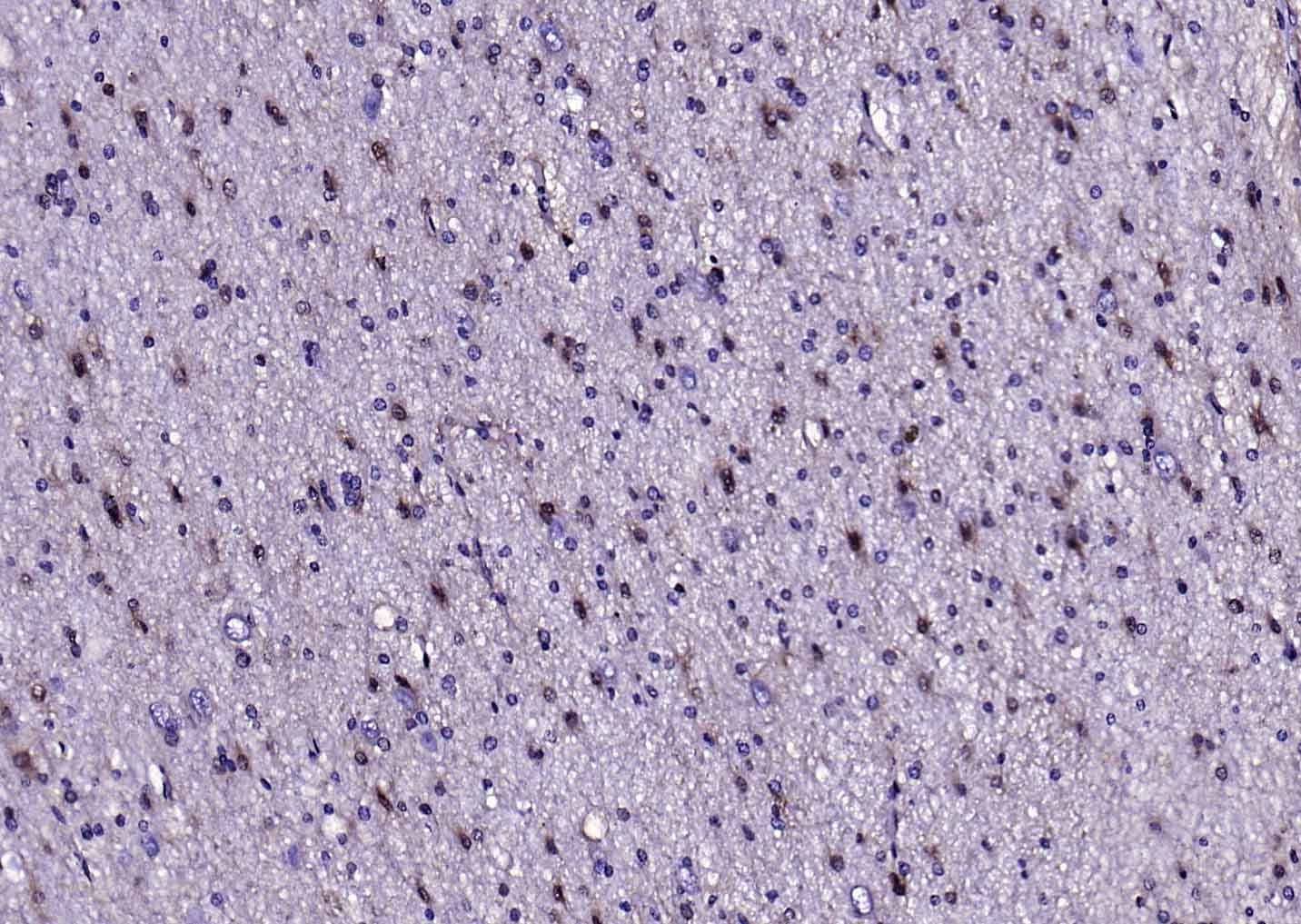 Anti-S100B Polyclonal Antibody