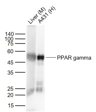 Anti-PPAR gamma/PPARG Antibody (1Z782)