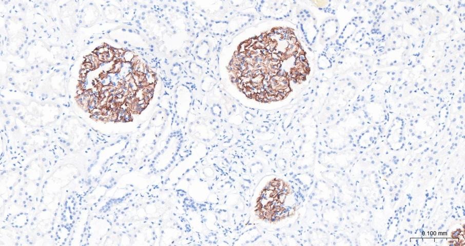 Anti-Podocin Polyclonal Antibody