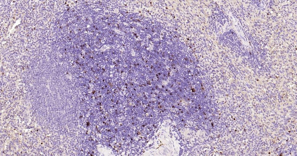 Anti-S100B Antibody (2F740)