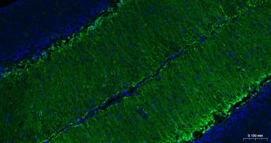 Anti-S100B Antibody (2F740)
