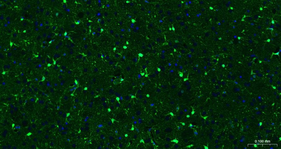 Anti-S100B Antibody (2F740)