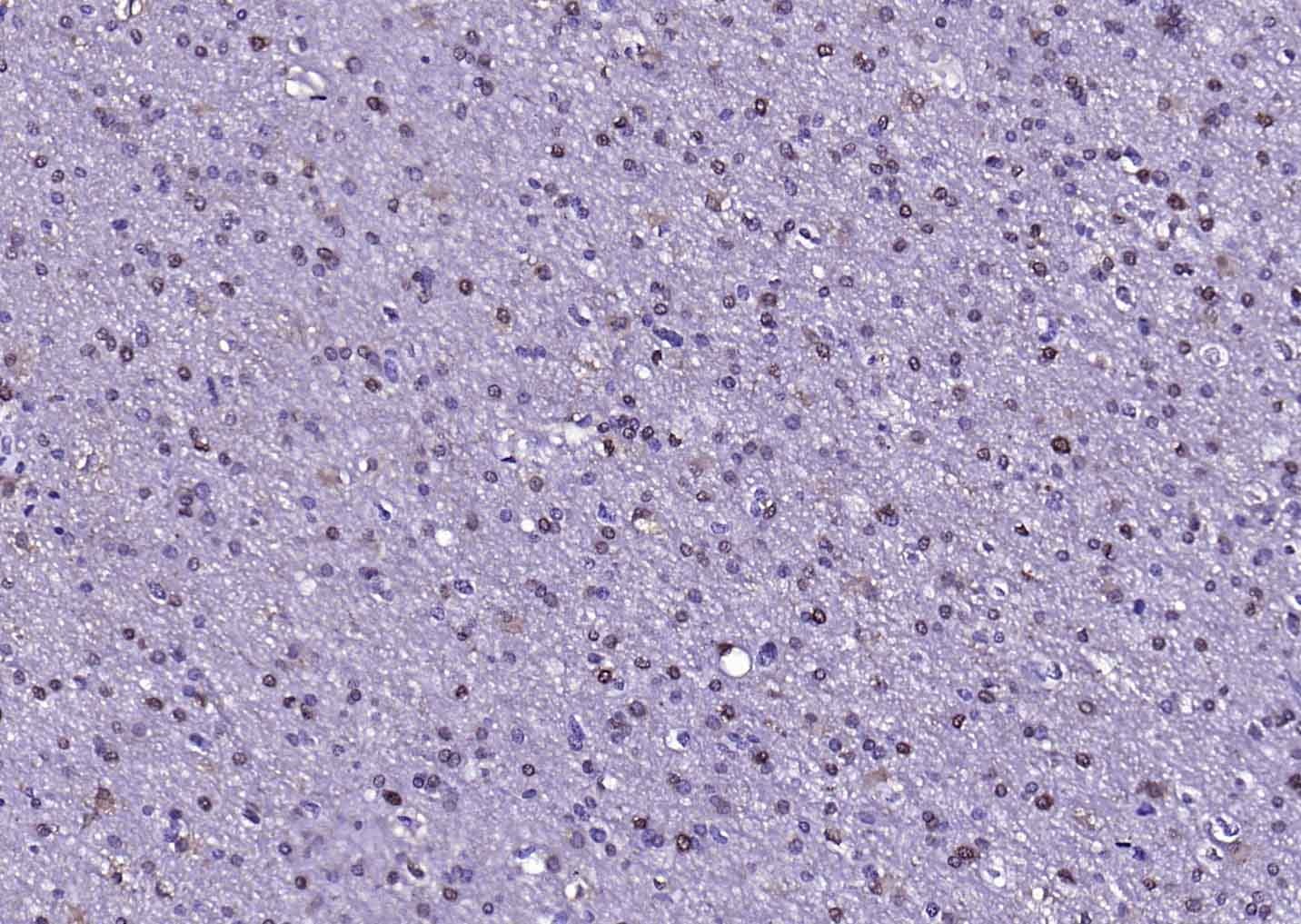Anti-S100B Polyclonal Antibody