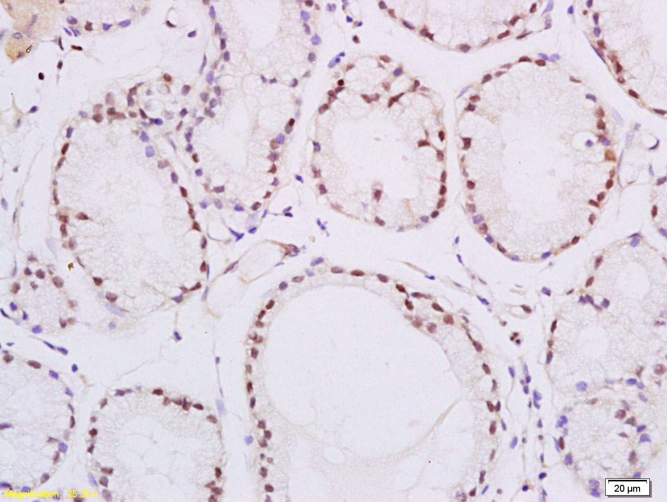 Anti-PPAR delta/beta Polyclonal Antibody