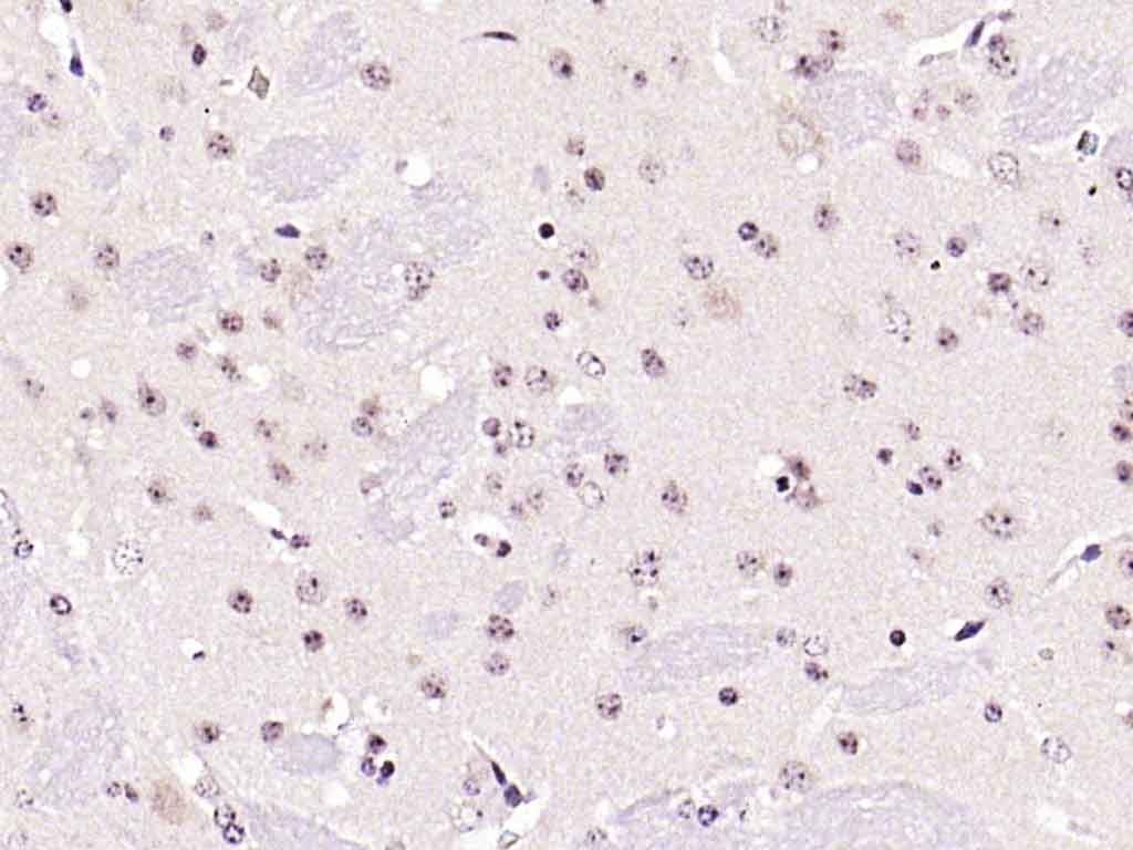 Anti-PPAR alpha/PPARA Polyclonal Antibody 2