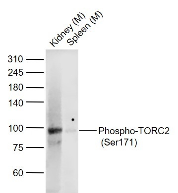 Anti-Phospho-TORC2 (Ser171) Polyclonal Antibody