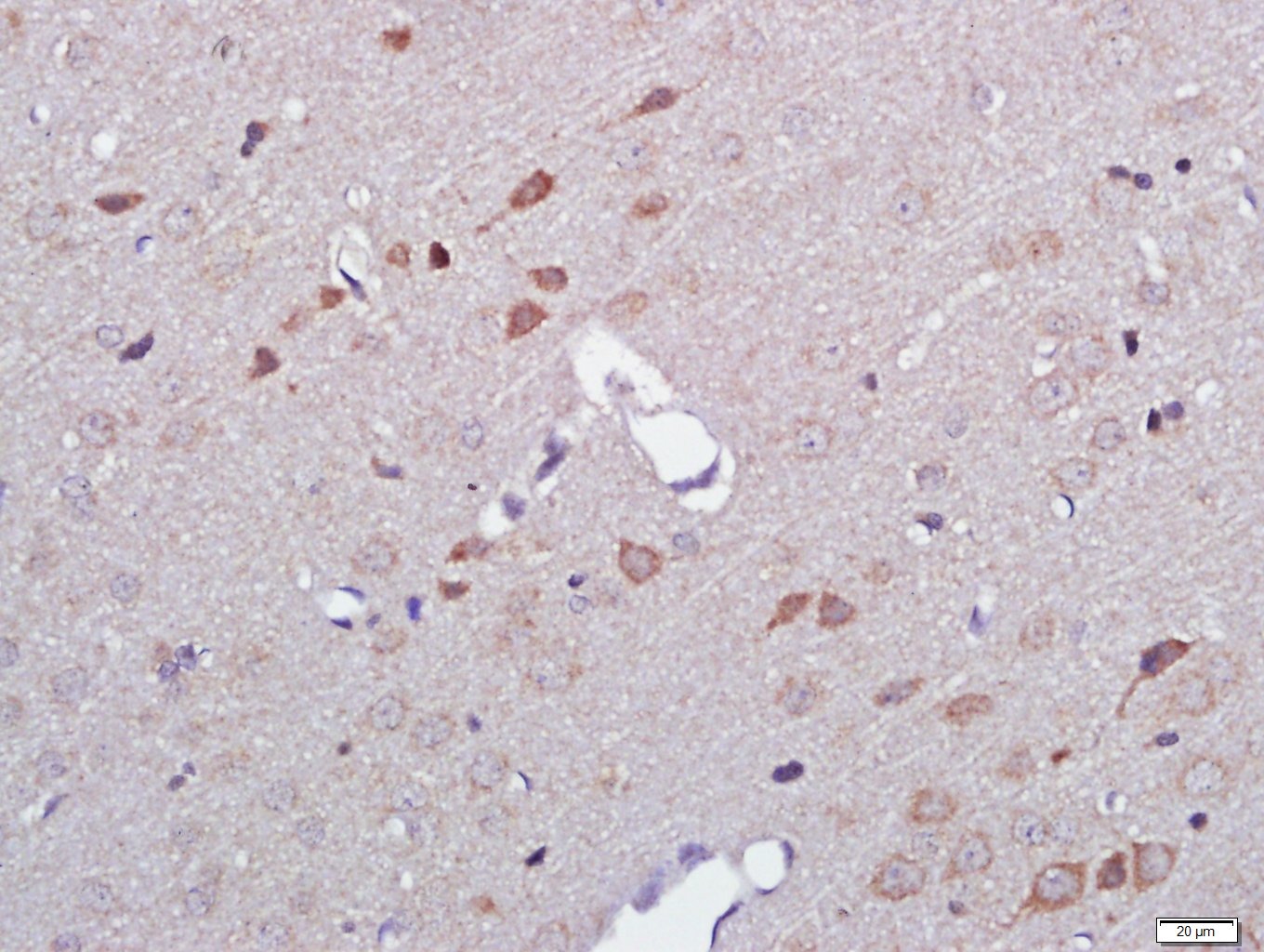 Anti-Podoplanin Polyclonal Antibody