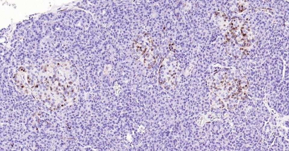 Anti-S100B Antibody (2F740)