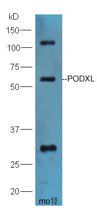 Anti-PODXL Polyclonal Antibody