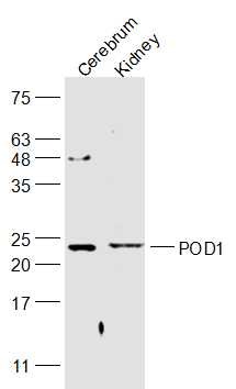 Anti-POD1 Polyclonal Antibody