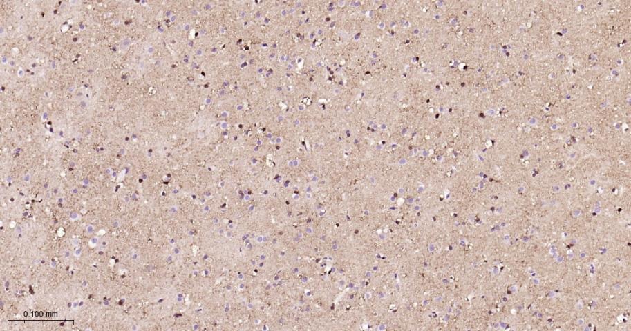 Anti-S100B Antibody (2F740)