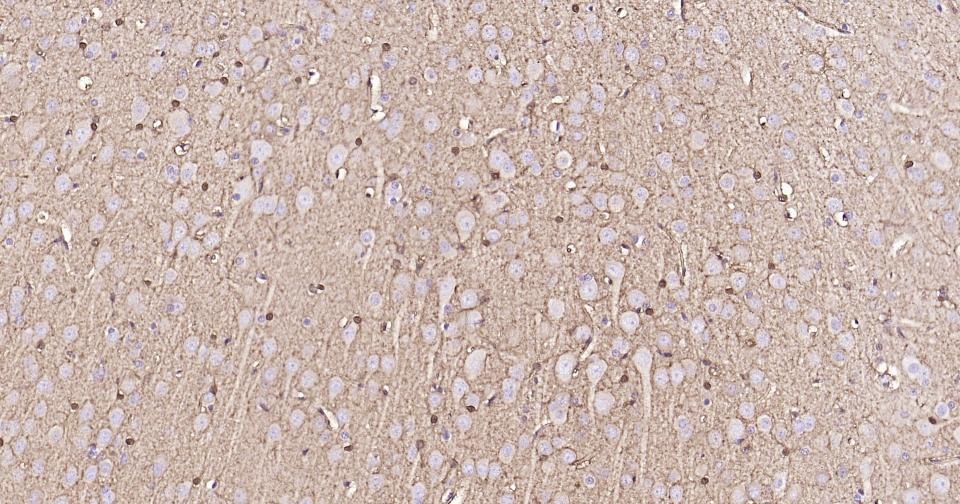 Anti-S100B Antibody (2F740)