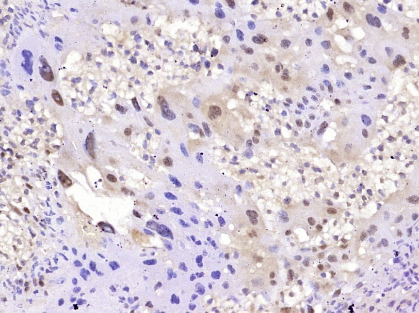 Anti-PPAR gamma/PPARG Antibody (1Z782)