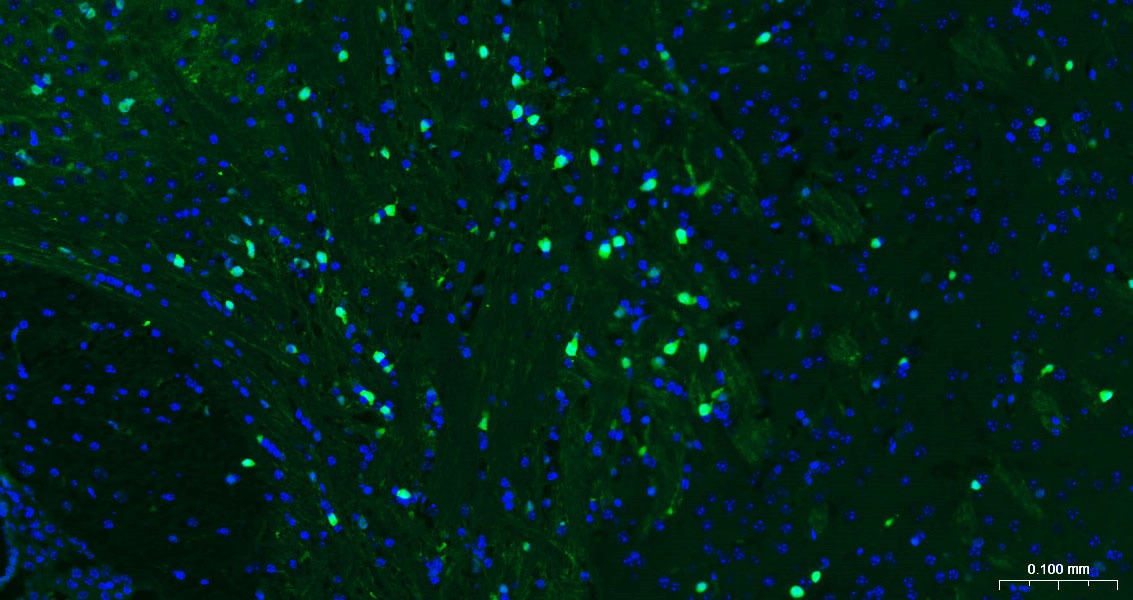 Anti-S100B Antibody (2F740)